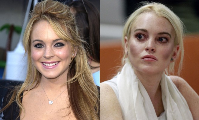 8 Celeb Faces Destroyed By Drugs