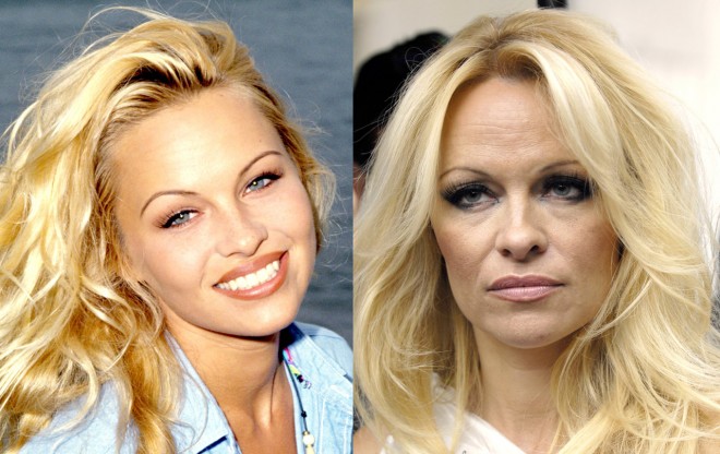 6 Celebrity Faces Destroyed By Drugs